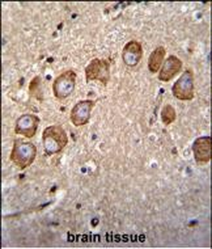 VSTM2B Antibody (N-term)