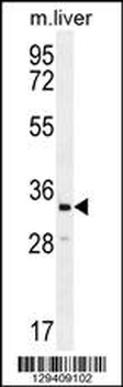 RLBP1L2 Antibody (C-term)