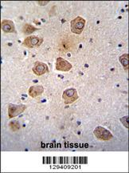 RLBP1L2 Antibody (C-term)