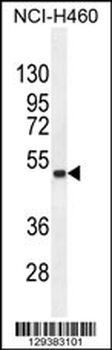 FNDC8 Antibody (Center)