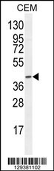 F8A2 Antibody (N-term)