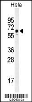 WDR70 Antibody (C-term)