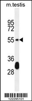 KT33A Antibody (N-term)