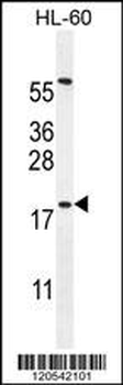 DPPA5 Antibody (N-term)