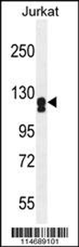 ADCY2 Antibody (Center)