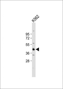 YOD1 Antibody (C-term)