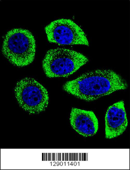 PIP5KL1 Antibody (N-term)