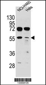 TSPYL6 Antibody (Center)