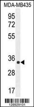 ALKBH6 Antibody (Center)