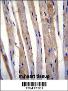 KRT73 Antibody (C-term)