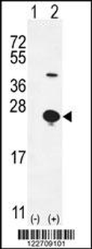 EPGN Antibody (N-term)