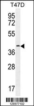FBLN7 Antibody (N-term)
