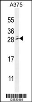 MBD3L2 Antibody (C-term)