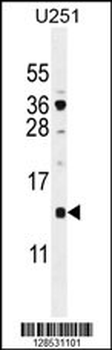 SFT2D2 Antibody (N-term)