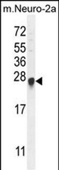 EMC7 Antibody (Center)