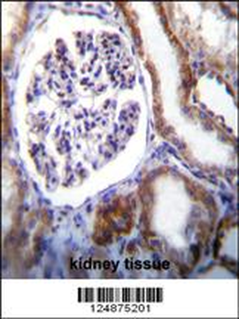 IFT88 Antibody (C-term)