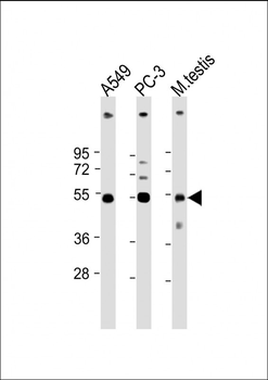 INHBB Antibody (C-term)