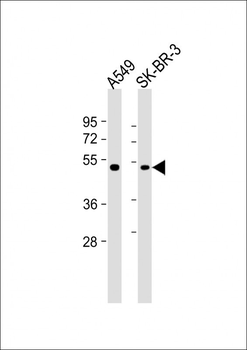 INHBB Antibody (C-term)