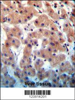 INHBB Antibody (C-term)