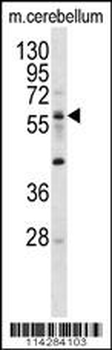 ELP3 Antibody (N-term)