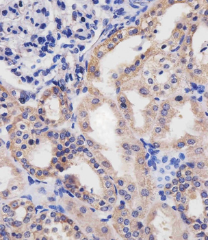 HTR2B Antibody (C-term E423)