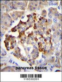 GAD2 Antibody (Center)
