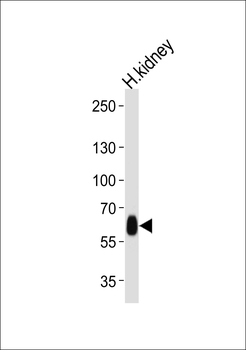 DFNB31 Antibody (Center)