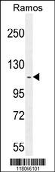 HIP1R Antibody (N-term)