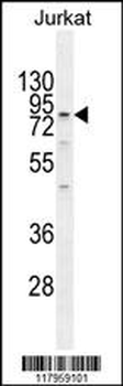 ELMO2 Antibody (Center)