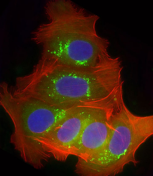 CYP2B6 Antibody (Center)