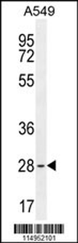 BTF3 Antibody (N-term)
