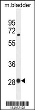 BTF3 Antibody (N-term)