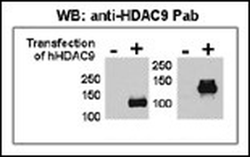HDAC9 Antibody (N-term)
