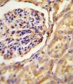 GNAT2 Antibody (Center)