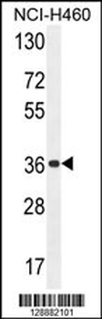 OR4A47 Antibody (C-term)