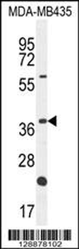 OR6V1 Antibody (C-term)