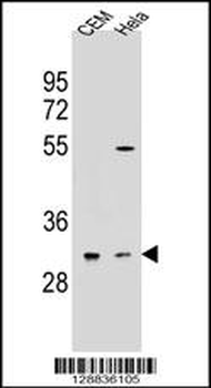 OR5L2 Antibody (N-term)