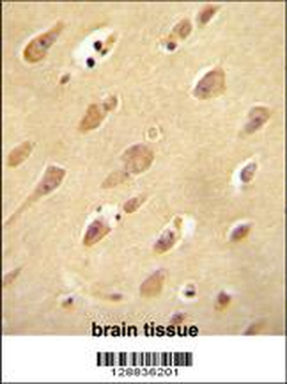 OR5L2 Antibody (N-term)