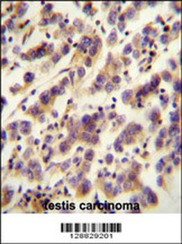 OR1J4 Antibody (C-term)