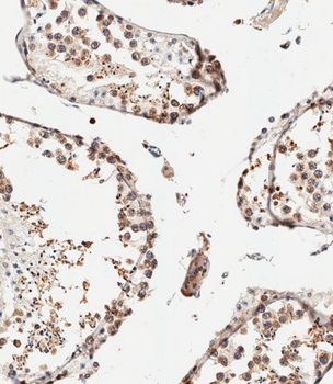 IFITM5 Antibody (Center)