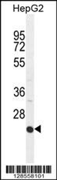 ICAM2 Antibody (Center)