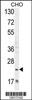 RILPL2 Antibody (Center)