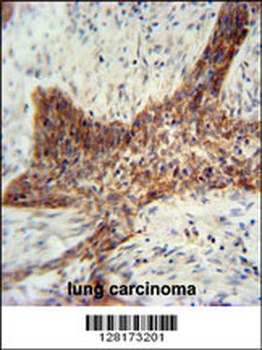 RILPL2 Antibody (Center)
