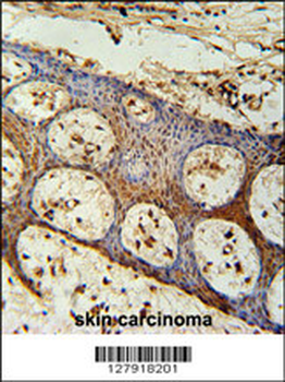 ZC3H3 Antibody (C-term)
