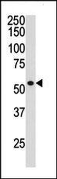 HDAC1 Antibody (C-term)