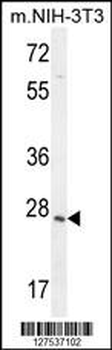 ZCCHC17 Antibody (Center)