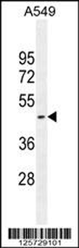HEMK1 Antibody (C-term)