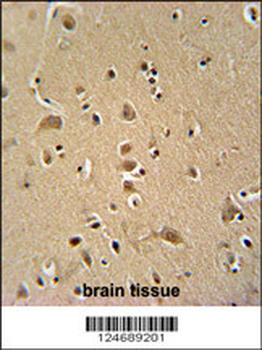 WIPF2 Antibody (C-term)