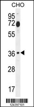 FOSL2 Antibody (Center)