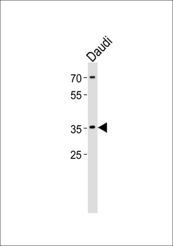 FOSL2 Antibody (Center)